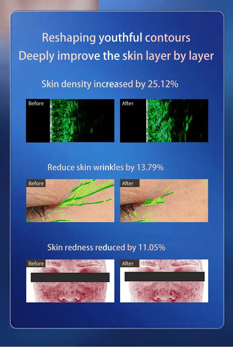 Facial & Body 3-in-1 Lifting Anti-Aging Firming Machine Nisiowelt