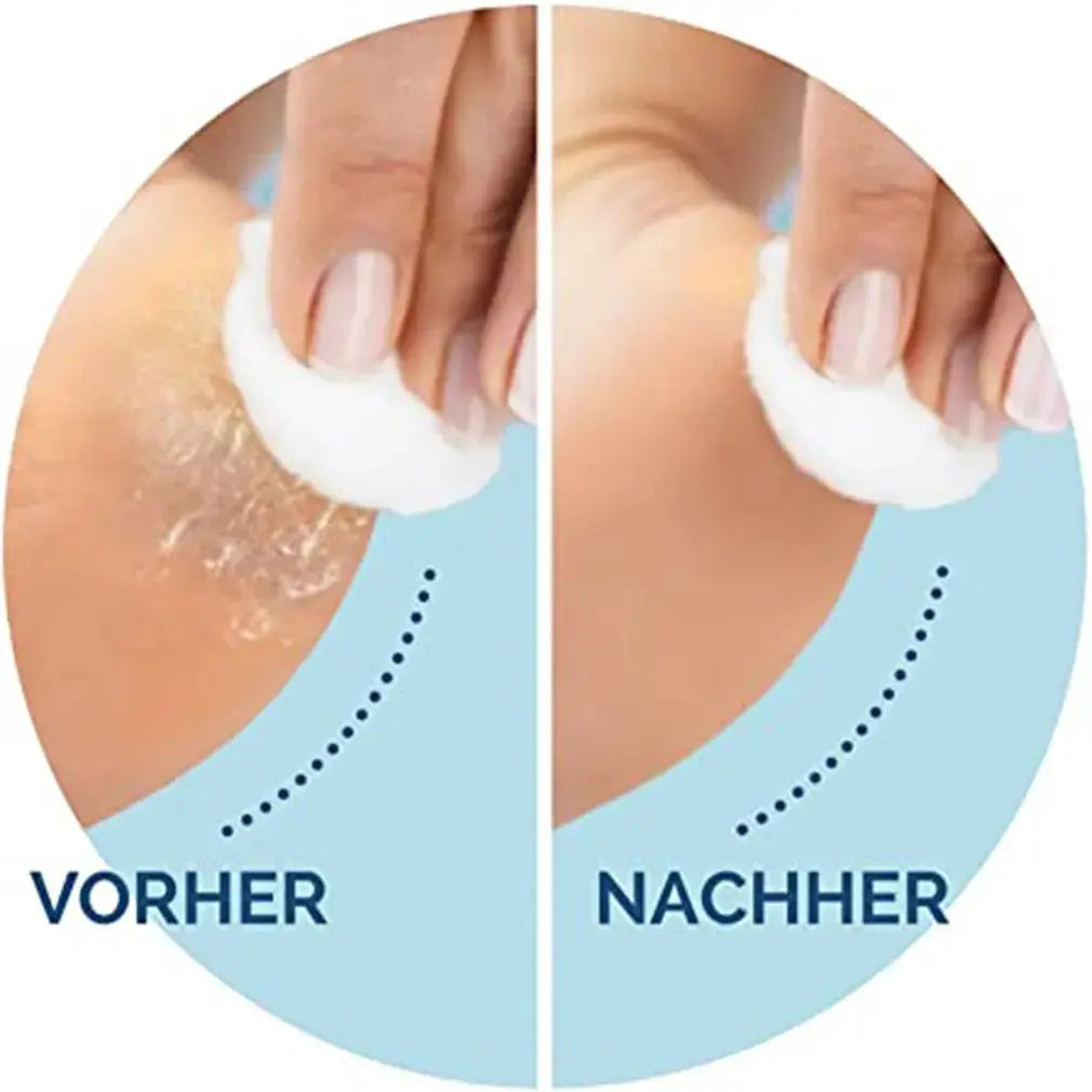 CorrectorFoot Care Tool Replacement Rollers - Nisiowelt