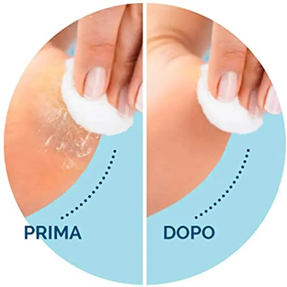 CorrectorFoot Care Tool Replacement Rollers - Nisiowelt