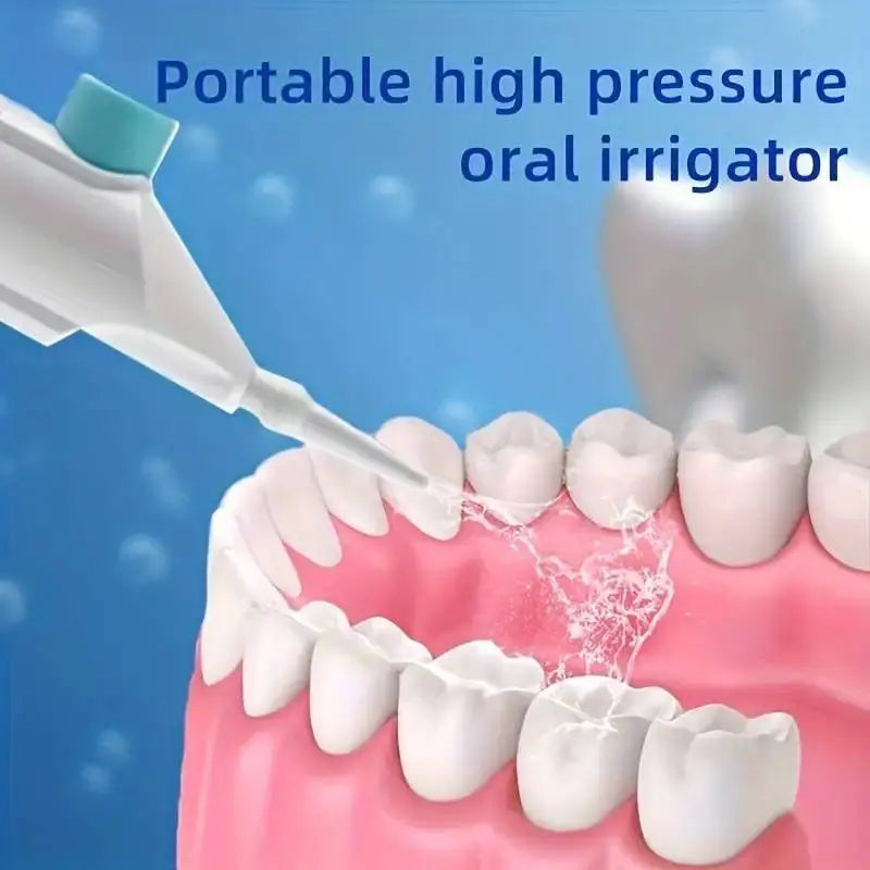 Portable High Pressure Oral Irrigator – Dental Water Floss - Nisiowelt