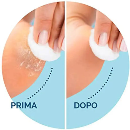CorrectorFoot Care Tool Replacement Rollers - Nisiowelt